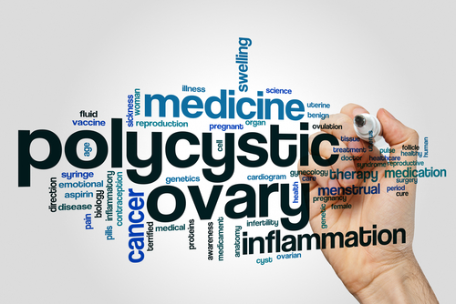 Polycistic Ovary